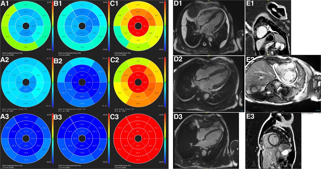 Patterns of CMR measured longitudinal strain and its association with late  gadolinium enhancement in patients with cardiac amyloidosis and its mimics, Journal of Cardiovascular Magnetic Resonance