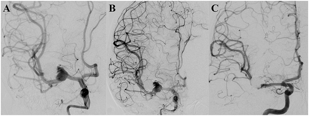 Neurology International, Free Full-Text