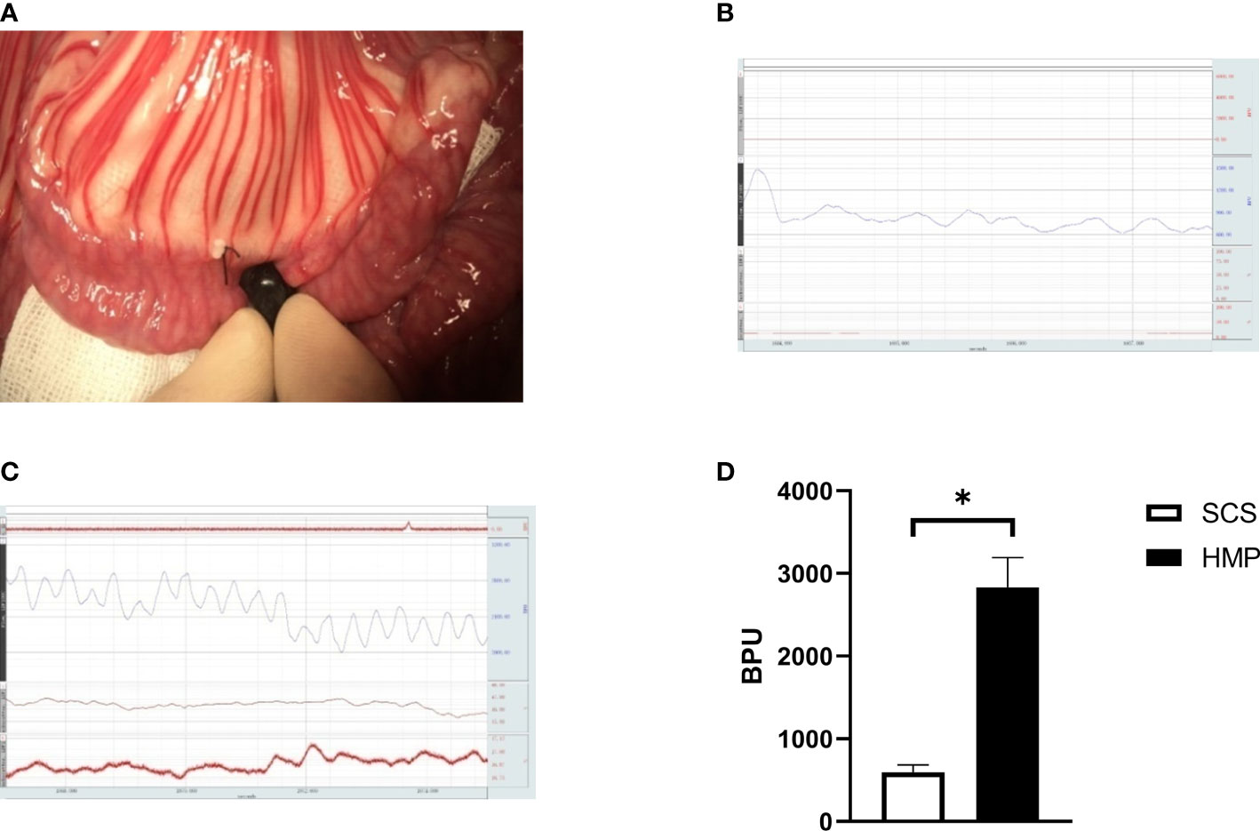 Frontiers  Hypothermic machine perfusion alleviates ischemia-reperfusion  injury of intestinal transplantation in pigs