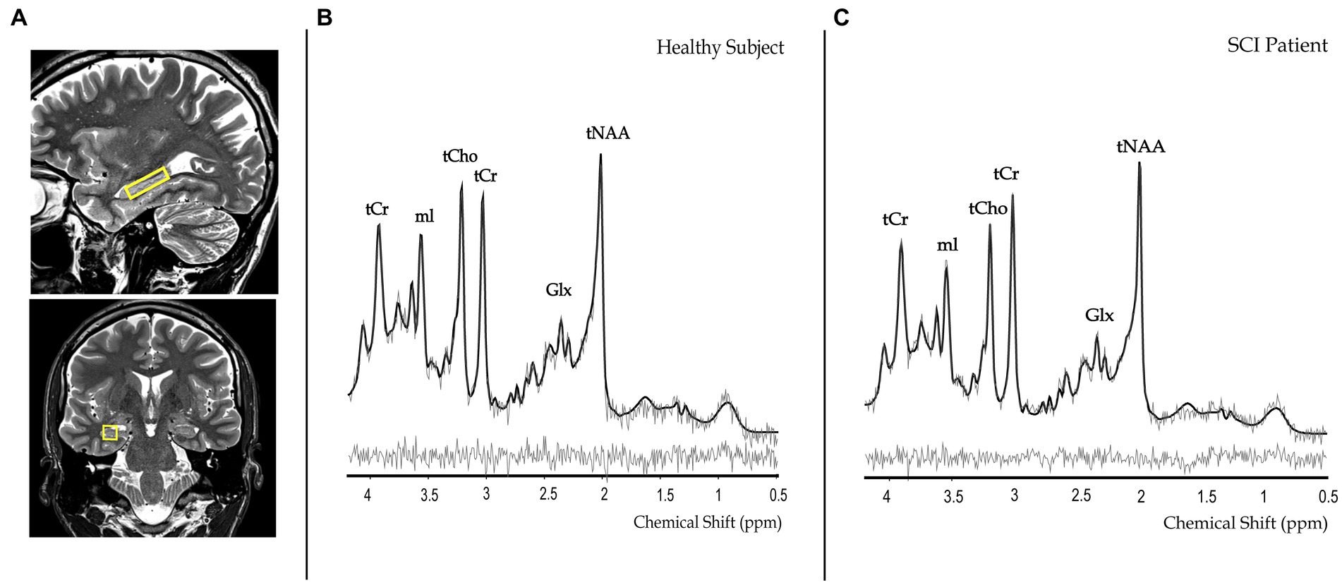 Frontiers | Magnetic resonance spectroscopy investigation in the 