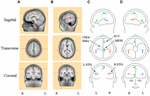 Frontiers | Source analysis of electrophysiological correlates of beat ...