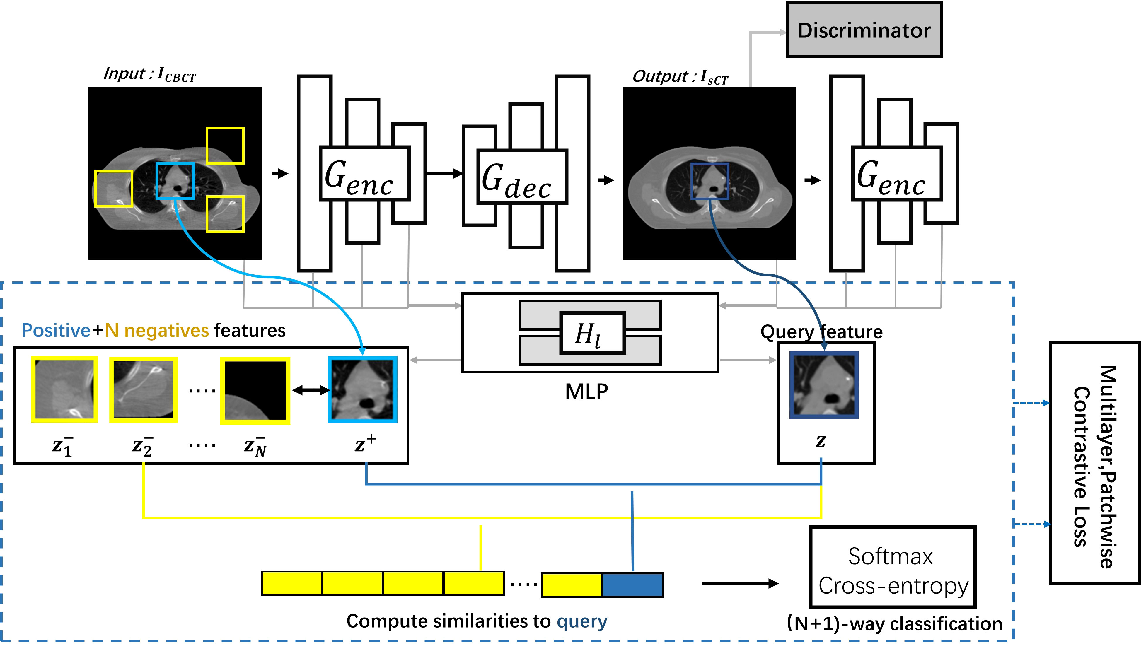 Synthetic CT generation from cone-beam CT using deep-learning for breast  adaptive radiotherapy - ScienceDirect