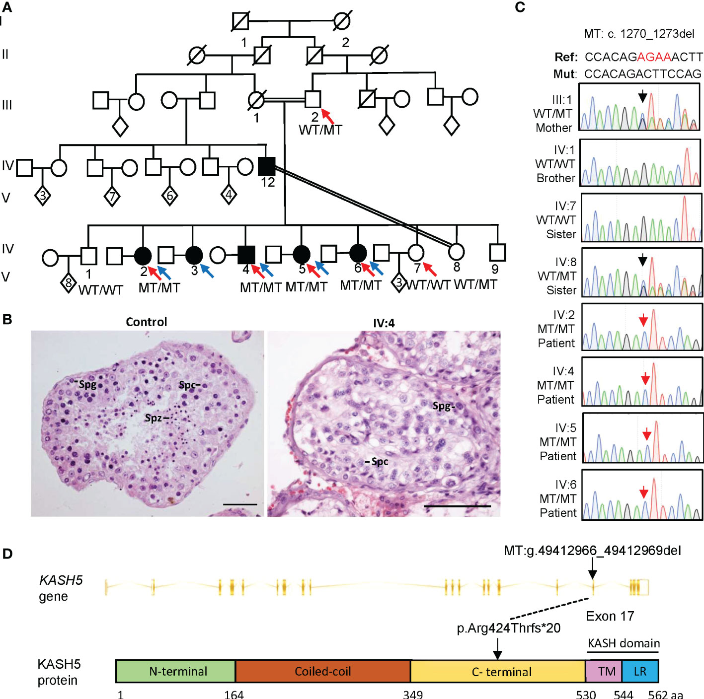 Frontiers  A homozygous KASH5 frameshift mutation causes diminished  ovarian reserve, recurrent miscarriage, and non-obstructive azoospermia in  humans