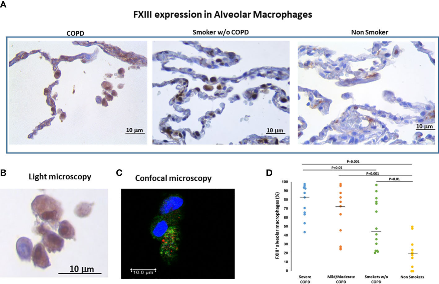 alveolar macrophage histology