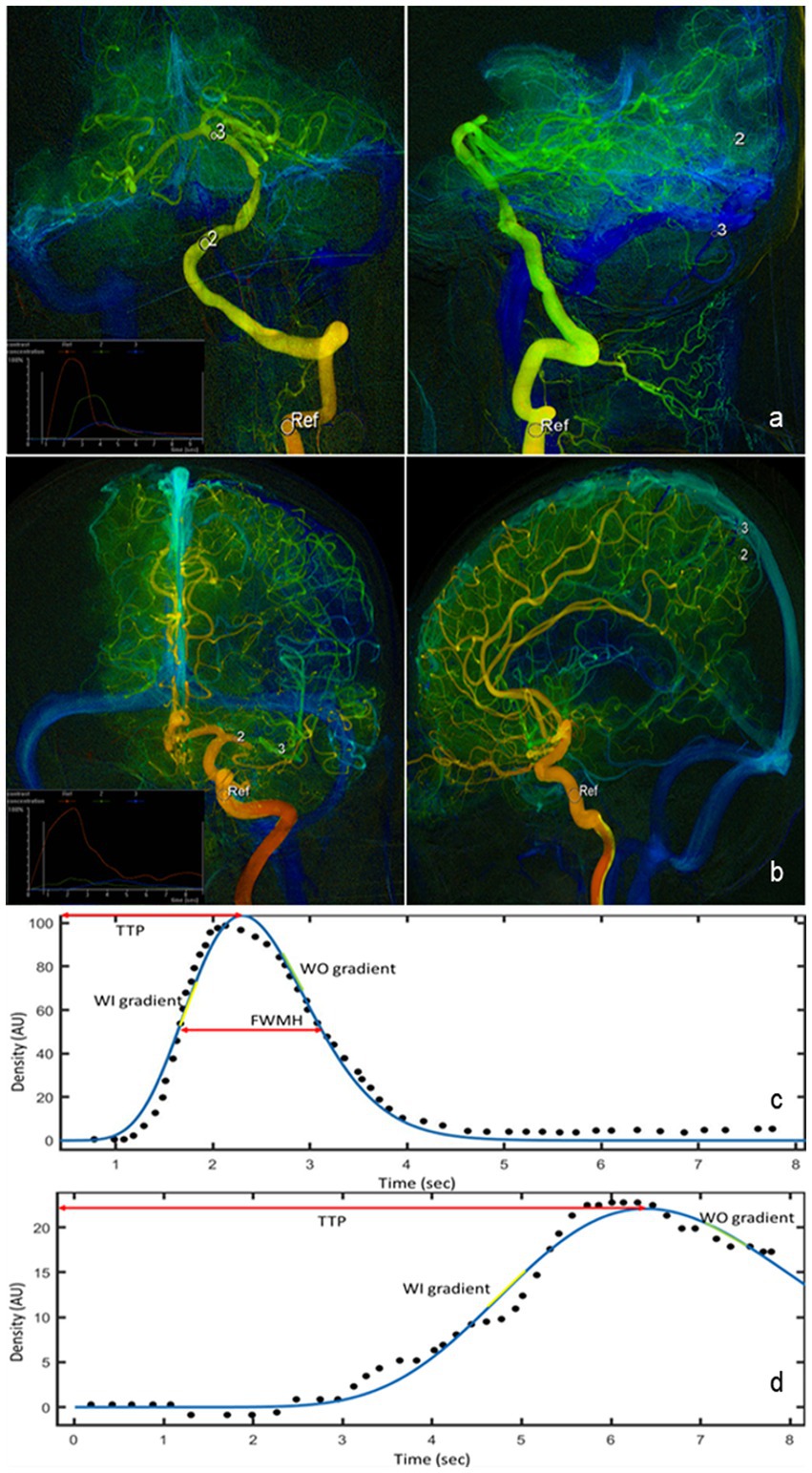 Electroanatomical Navigation to Minimize Contrast Medium or X-Rays During  Stenting: Insights From an Experimental Model - ScienceDirect