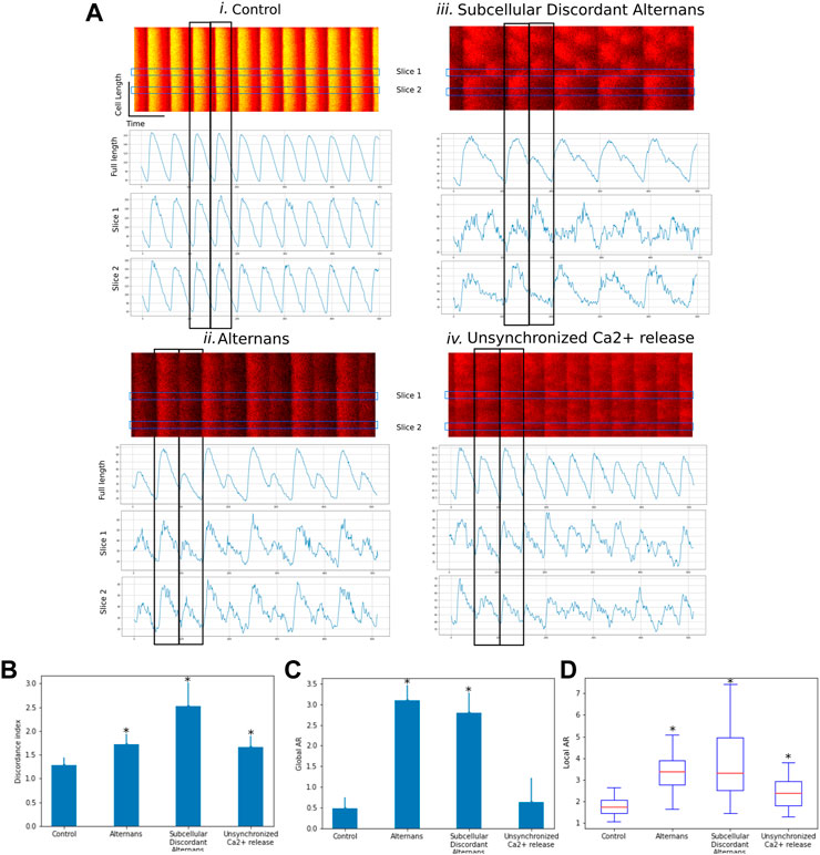 Frontiers  CardIAP: calcium transients confocal image analysis tool