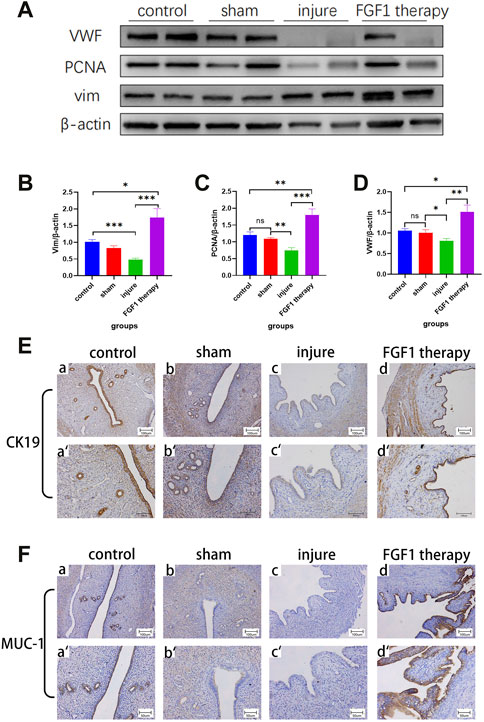 Frontiers | Fibroblast growth factor 1 ameliorates thin 