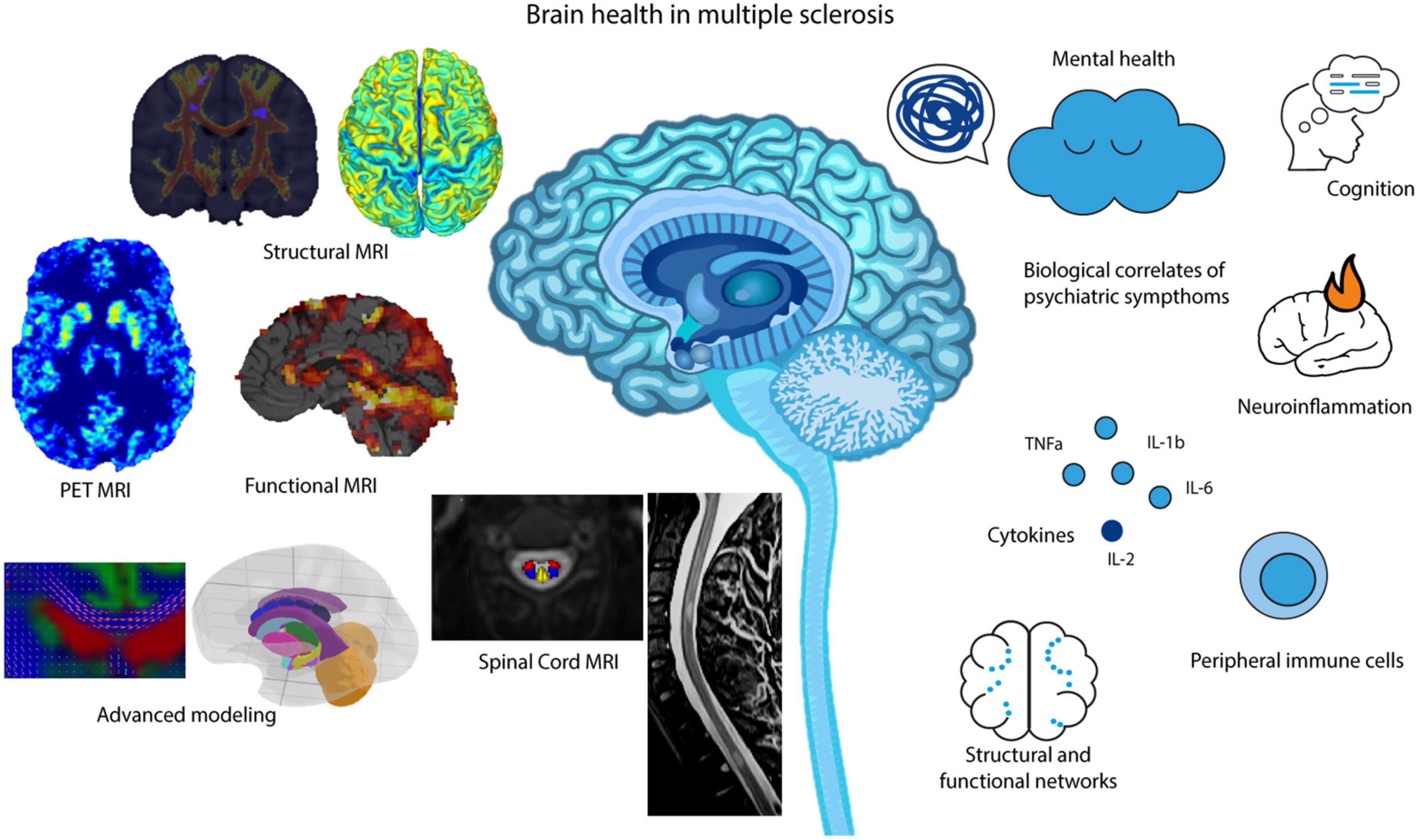 Frontiers | A review on multiple sclerosis prognostic findings from  imaging, inflammation, and mental health studies