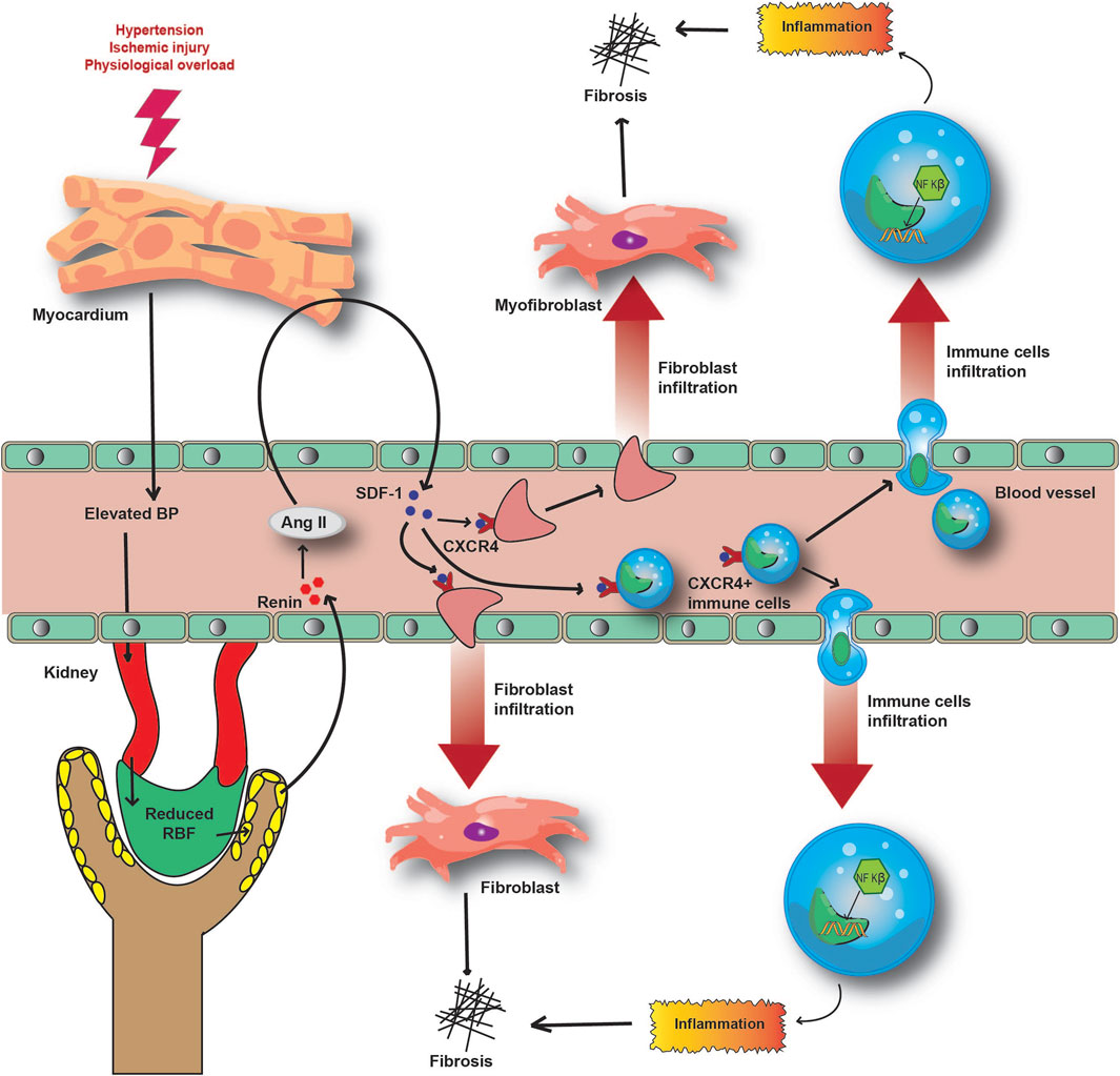 The Molecular Mechanism and Therapeutic Strategy of Cardiorenal Syndrome  Type 3