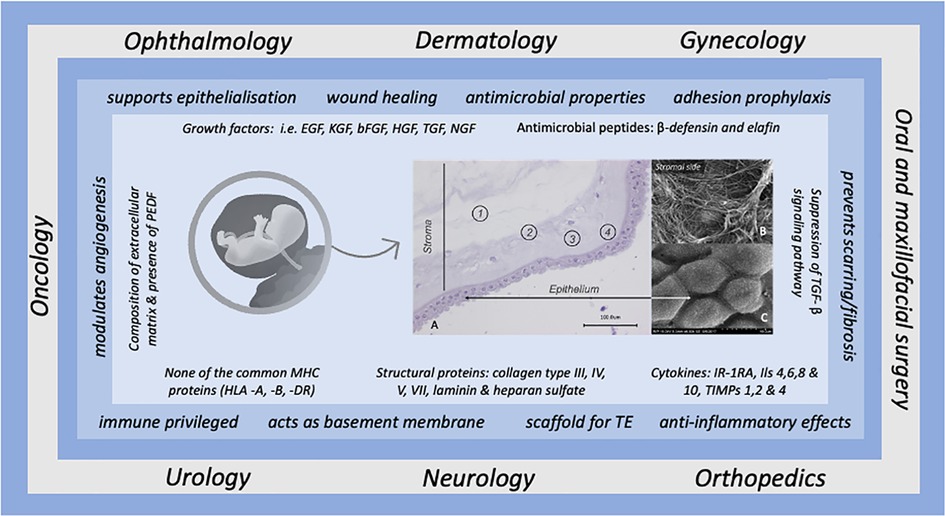 Frontiers  Preparation of human amniotic membrane for