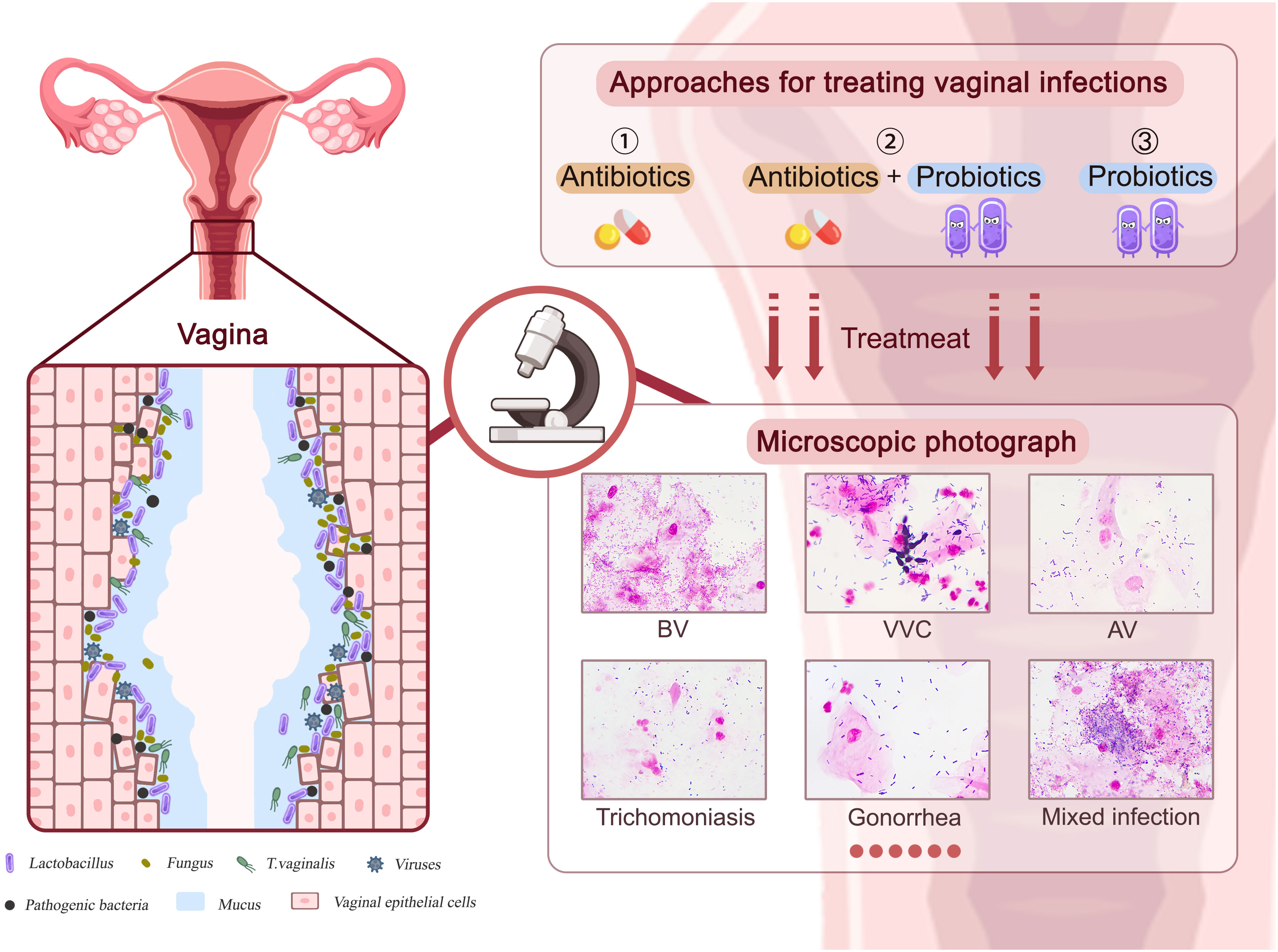Lactobacilli Probiotic Strains Adhered To Vaginal Epithelium Cells As ...