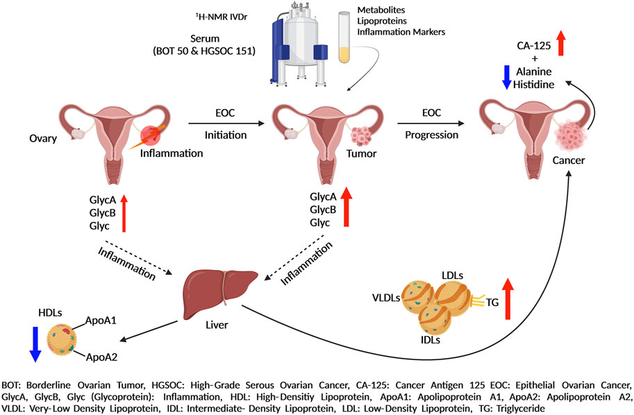 Frontiers Stratification Of Ovarian Cancer Borderline From High grade 