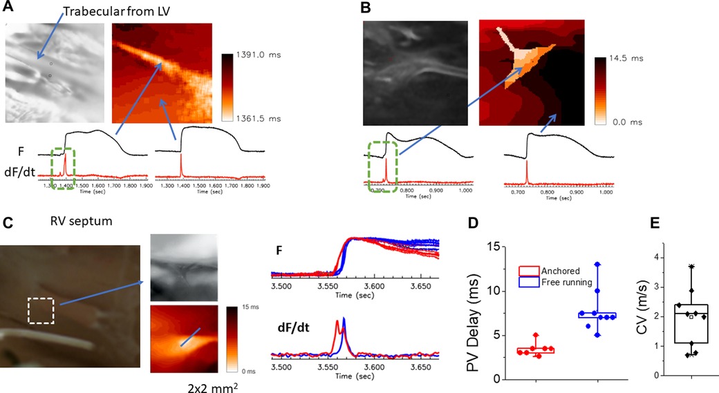 Frontiers | Conduction delays across the specialized conduction system ...