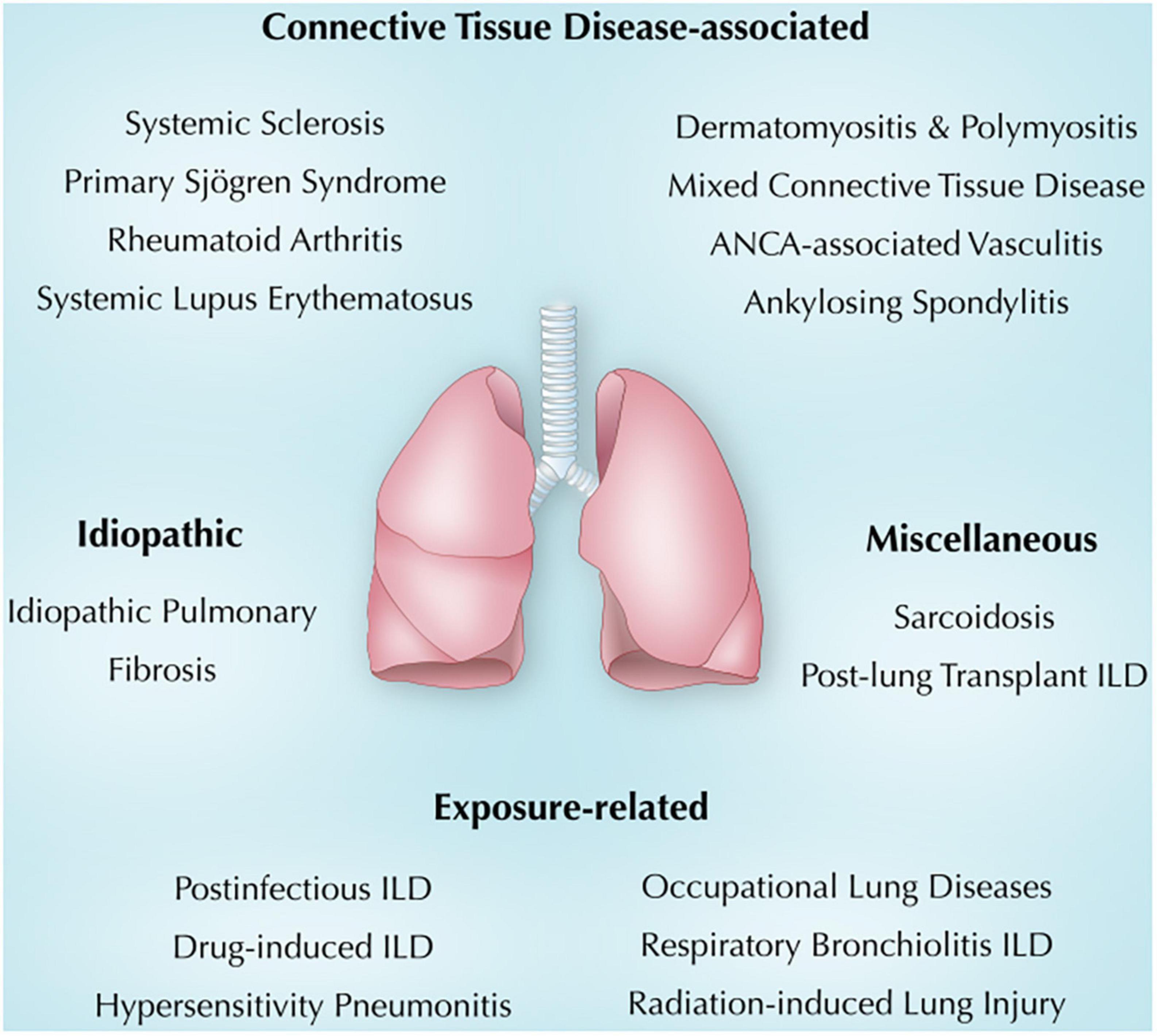 Priyanka Desai Sex Videos - Frontiers | Immune-mediated lung diseases: A narrative review