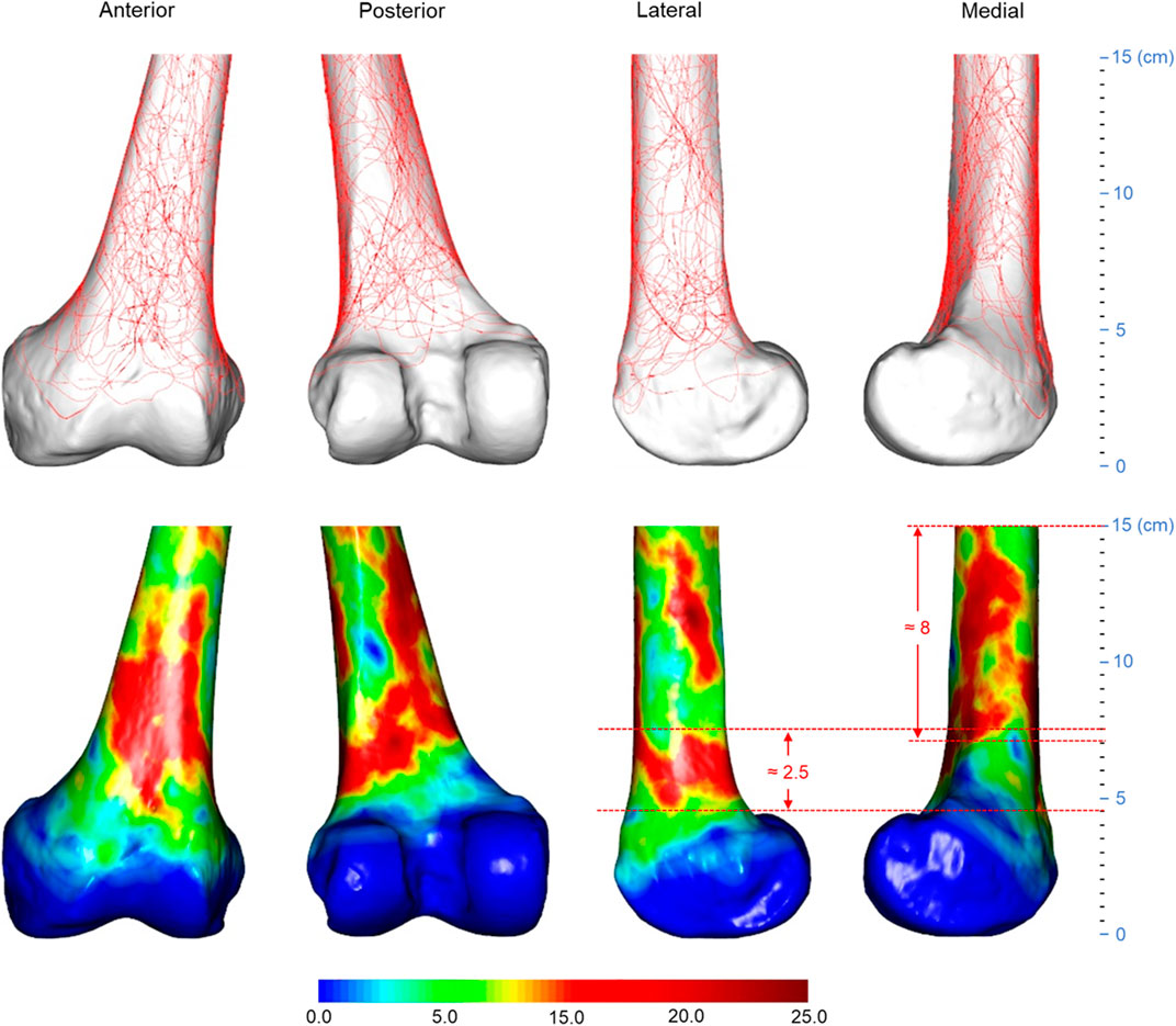 Frontiers  Three-dimensional computed tomography mapping techniques in the  morphometric analysis of AO/OTA 33A and 33C distal femoral fractures: a  retrospective single-center study