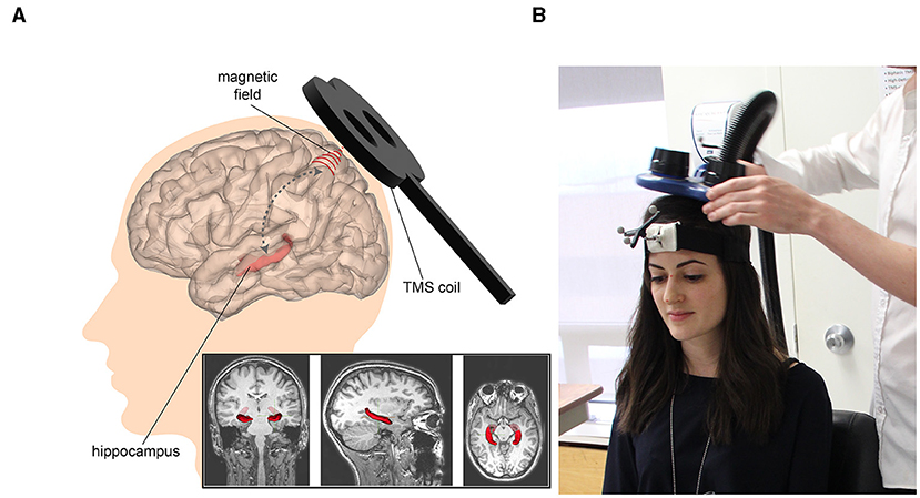 Figure 2 - (A) TMS works by sending a strong magnetic field through the skull, where it causes electrical stimulation of neurons.
