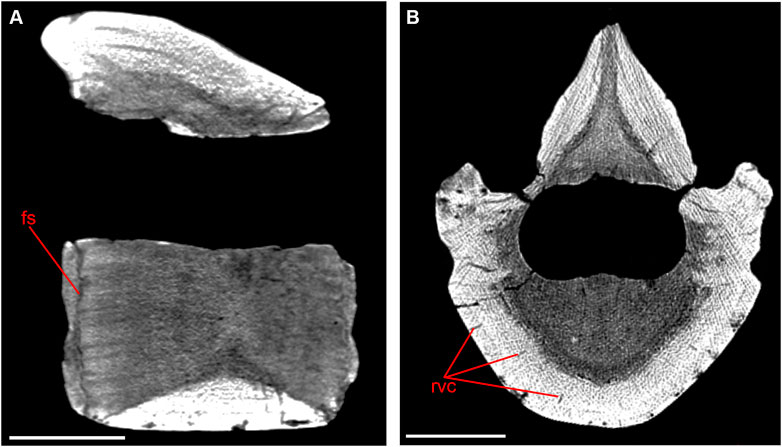 Whale Bone, Vertebra; Cetacea; Unaccessioned