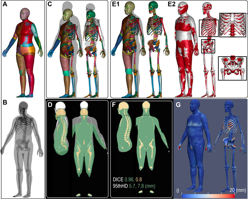 Frontiers  Personalization of human body models and beyond via image  registration
