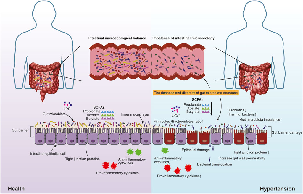 Frontiers | Targeting intestinal microecology: potential intervention ...