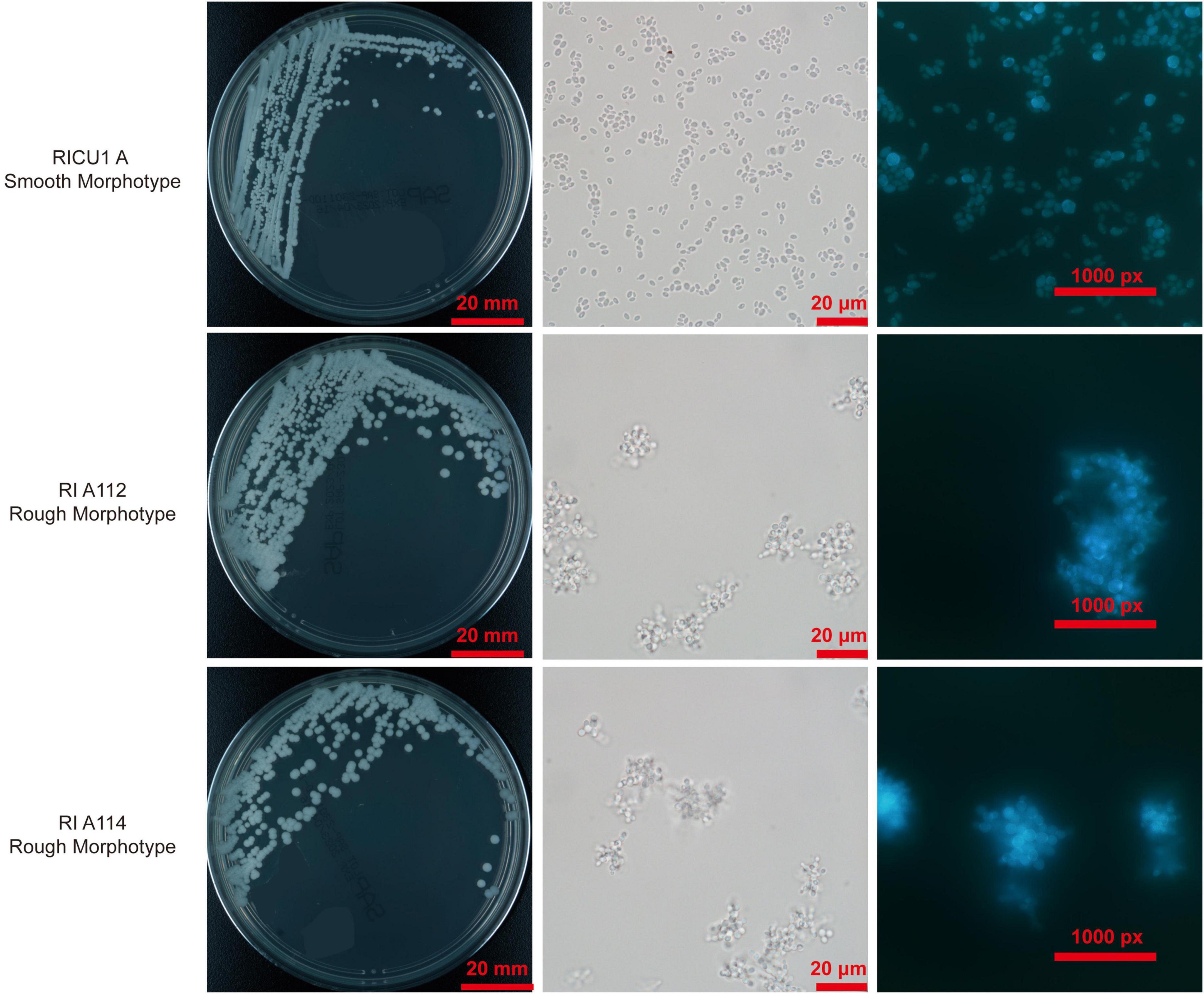 Frontiers Phenotypic And Genetic Features Of A Novel Clinically 