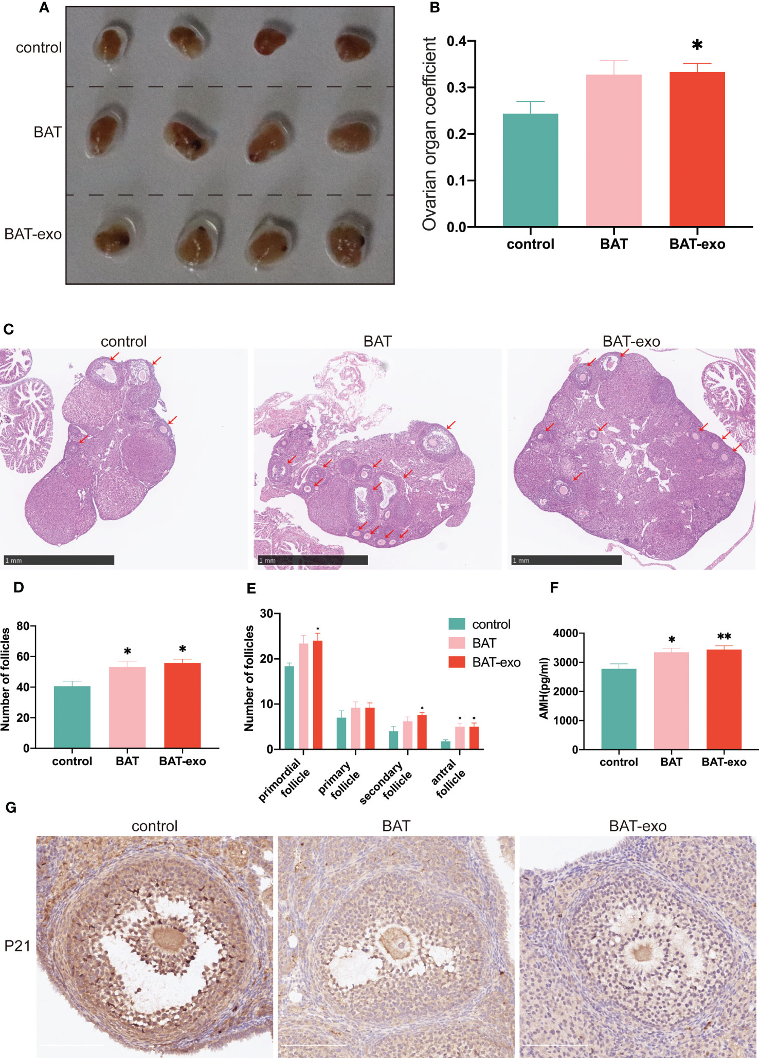 Frontiers | Brown adipose tissue-derived exosomes delay fertility 