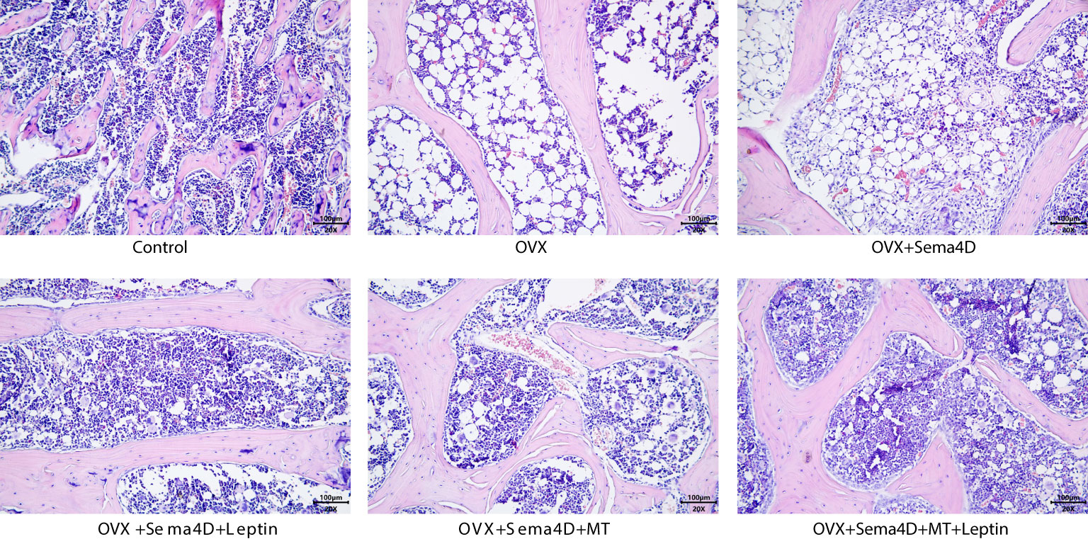 Frontiers | Leptin and melatonin’s effects on OVX rodents’ bone metabolism
