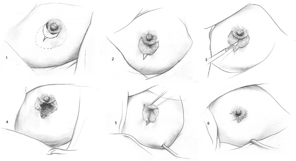 Asymmetric woman breast Royalty Free Vector Image