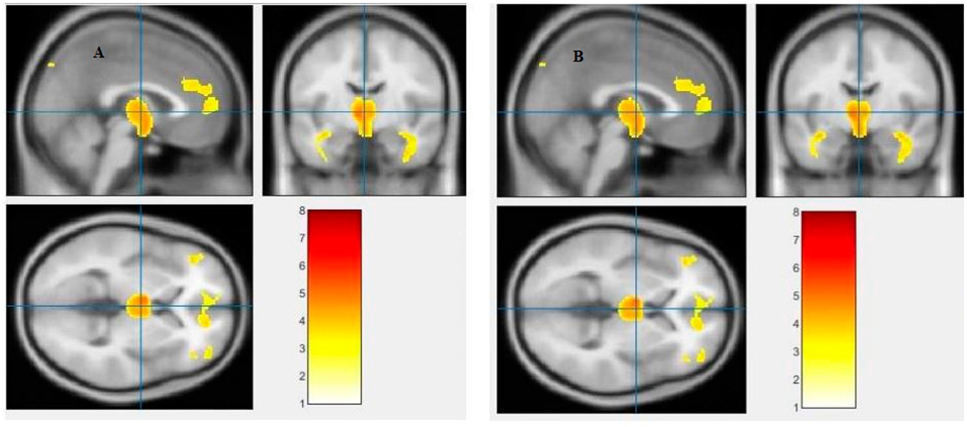 Insights Into Structural and Functional Organization of the Brain: Evidence  From Neuroimaging and Non-Invasive Brain Stimulation Techniques