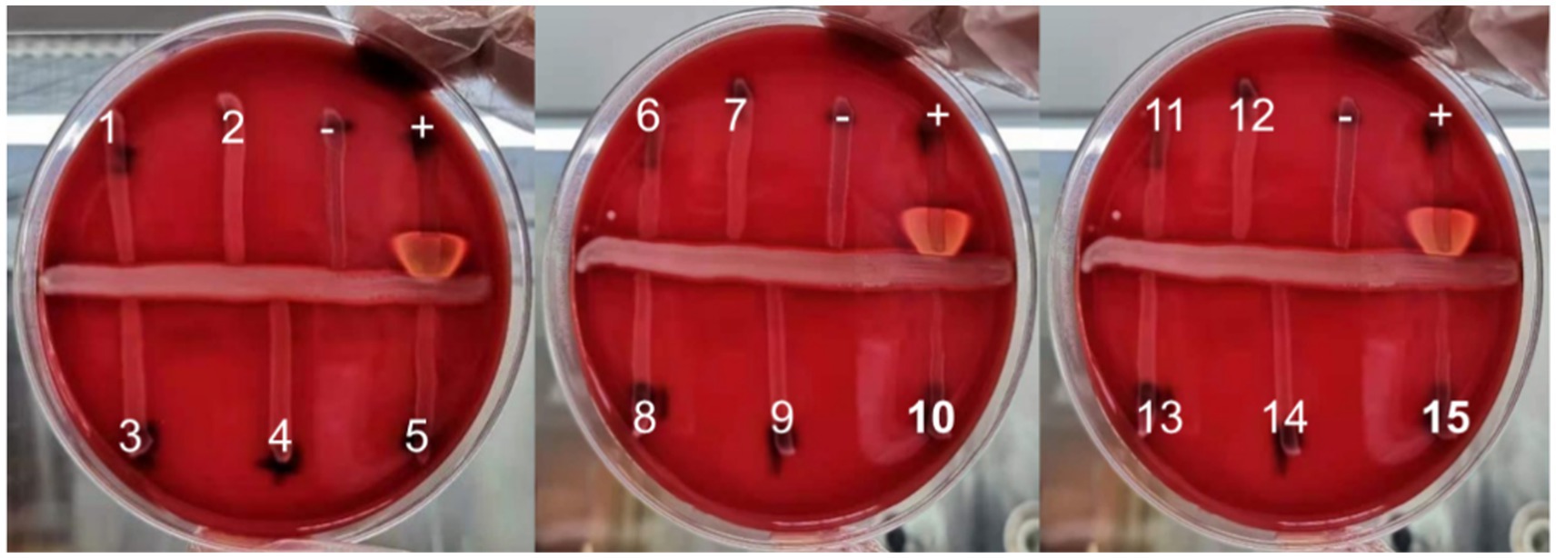 A) The CAMP test for identification of Group B streptococcus