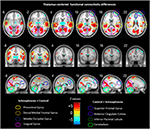 Frontiers | Disrupted thalamic resting-state functional networks in ...