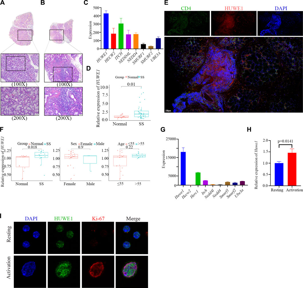 Frontiers  HECT, UBA and WWE domain containing 1 represses