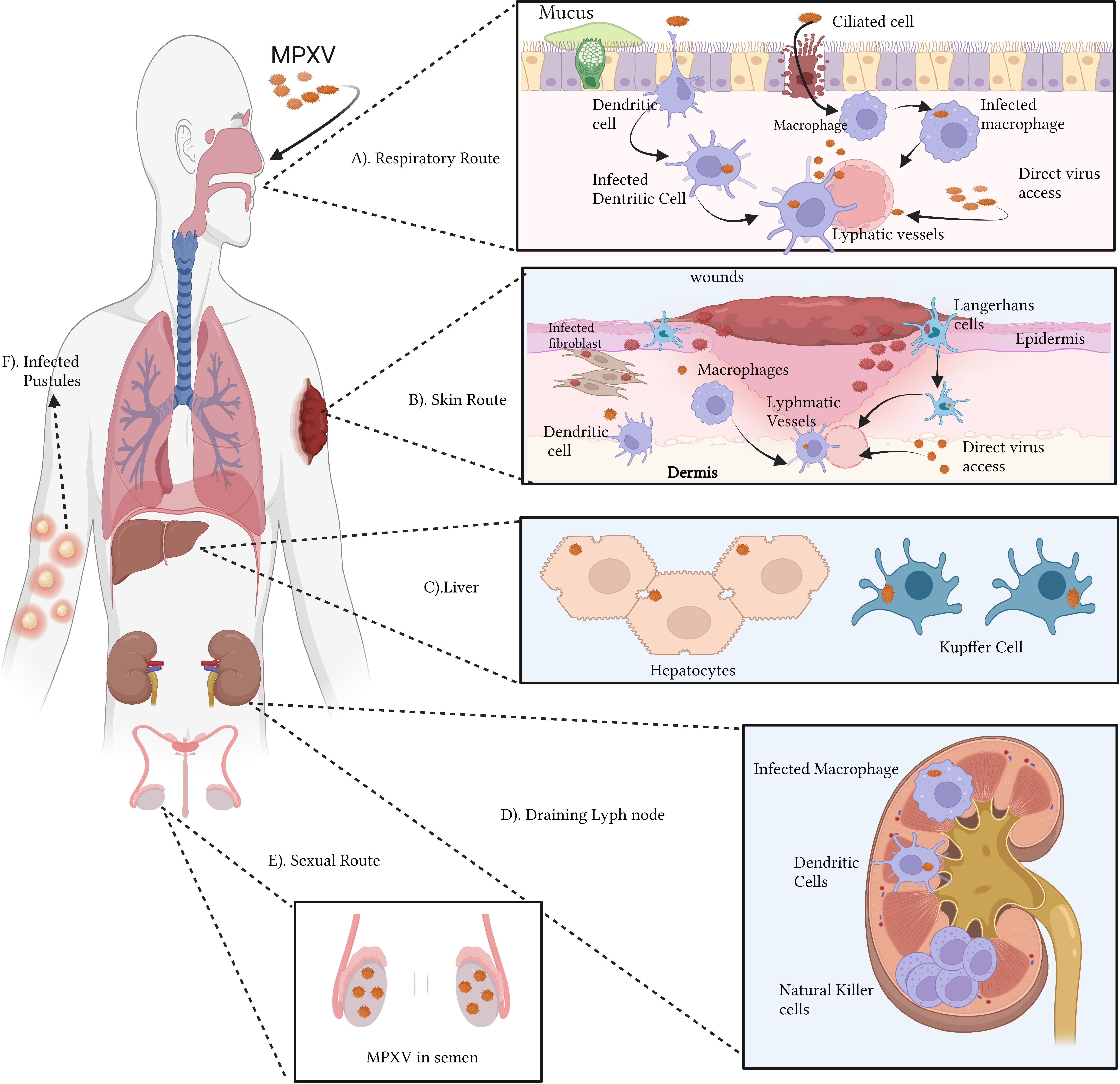 Frontiers | The Prospective Outcome Of The Monkeypox Outbreak In 2022 ...