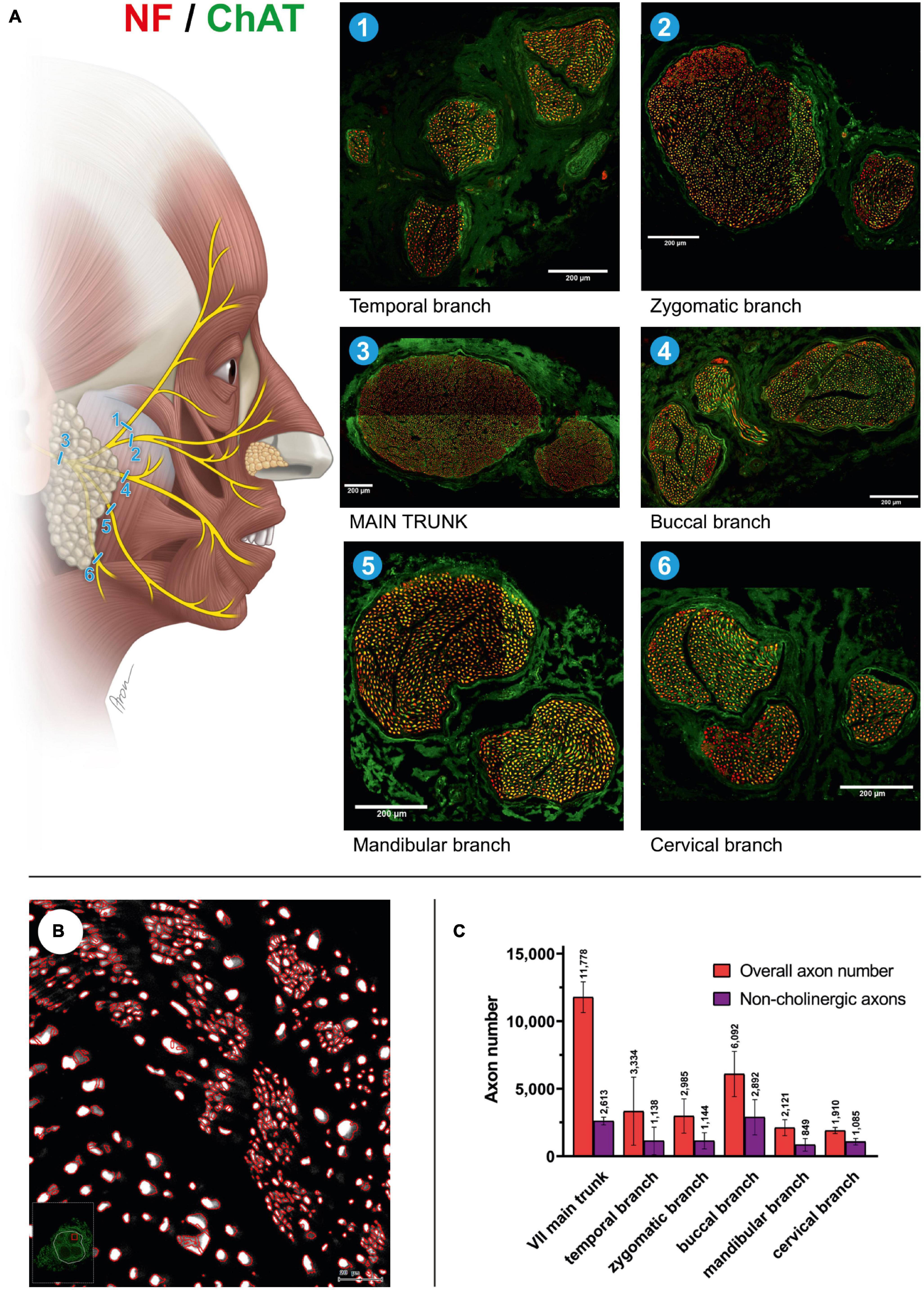 Frontiers | Axonal mapping of the motor cranial nerves