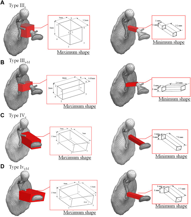 Characterization of Stapes Anatomy: Investigation of Human and