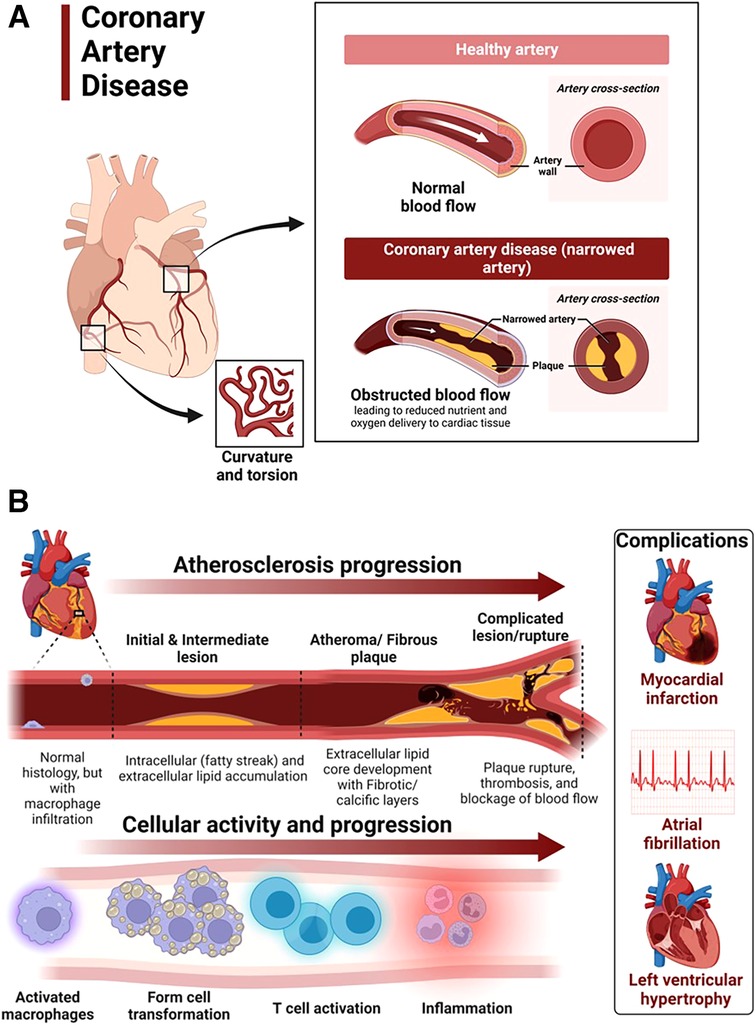 Frontiers Hypertensive Heart Disease Risk Factors Complications And Mechanisms
