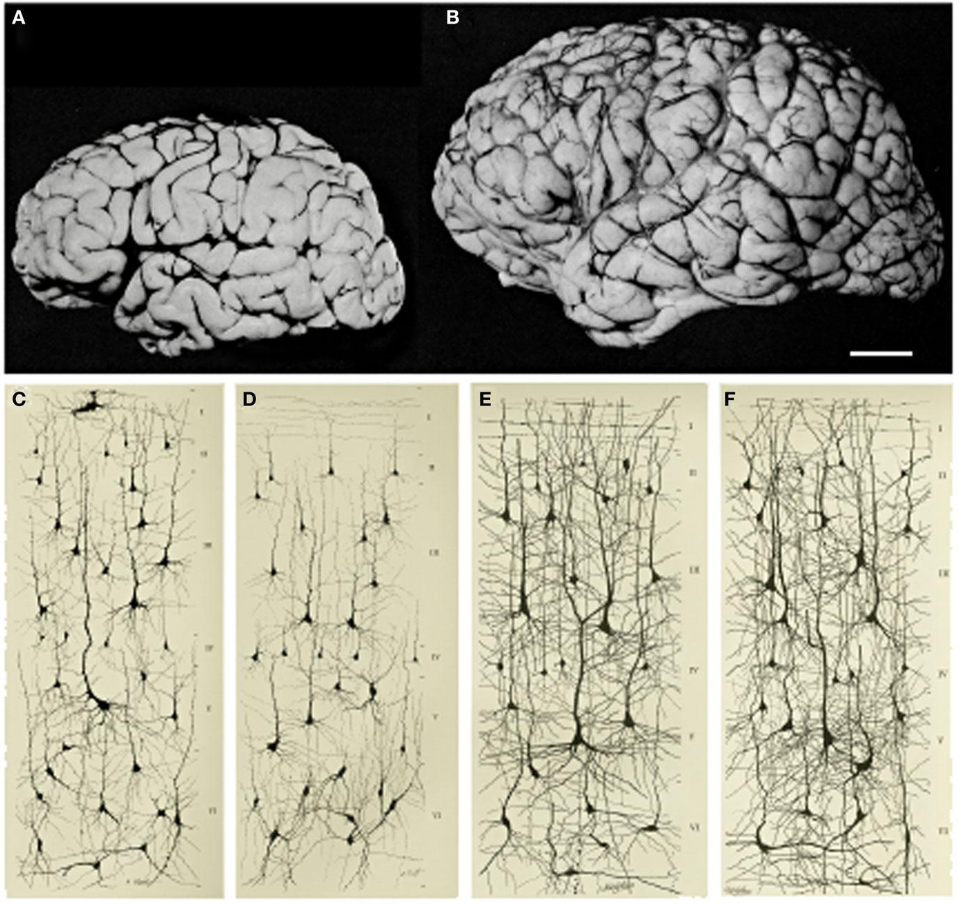 图1 -大脑体积的增加和皮层回路的成熟。