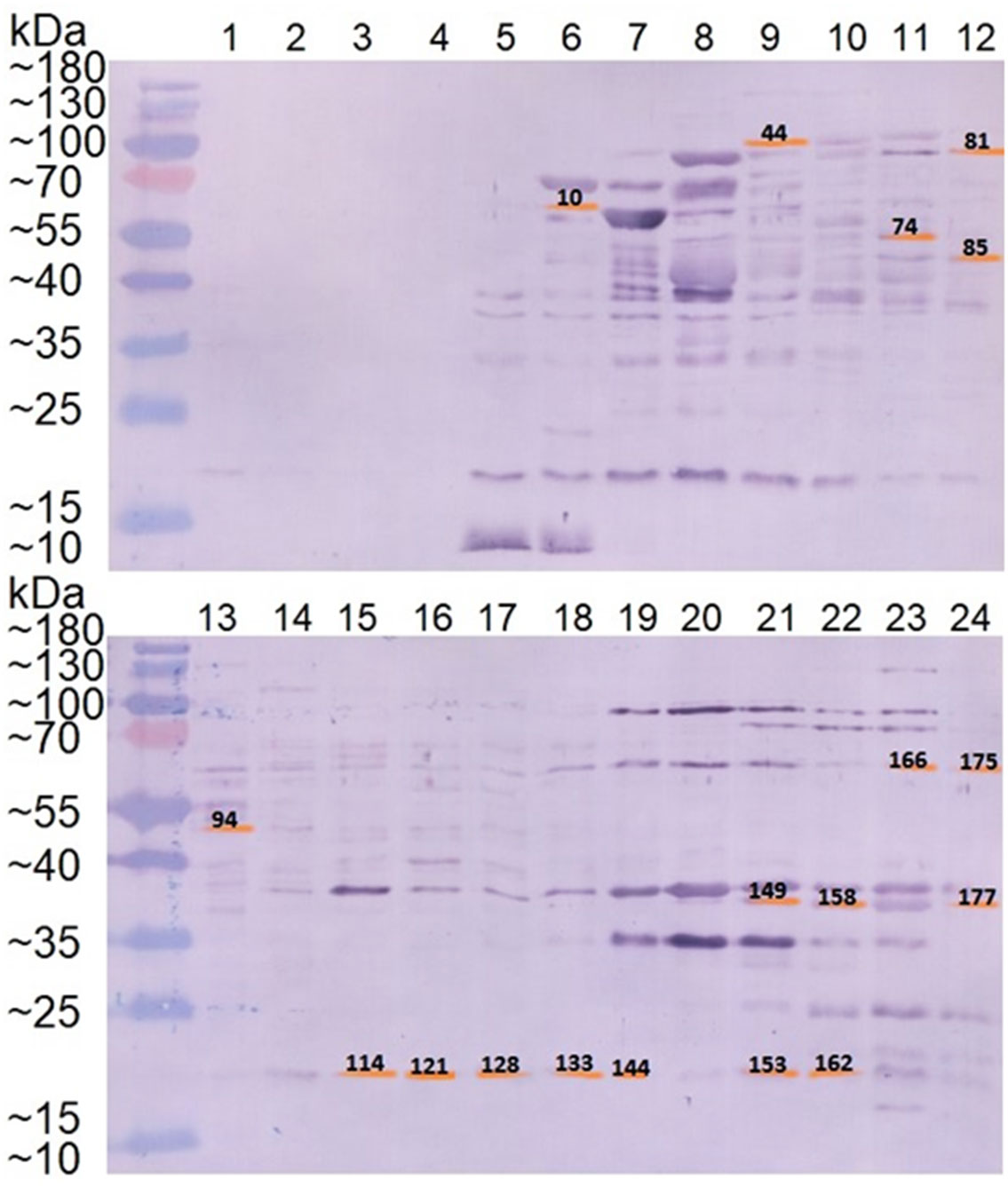 Frontiers  An immunoproteomics study of antisera from patients with  gonorrhea identifies novel Neisseria gonorrhoeae proteins