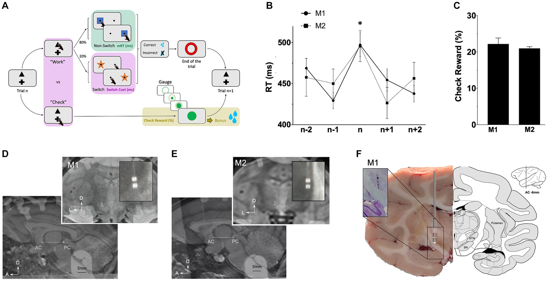 Frontiers  Stimulation of the Subthalamic Nucleus Changes