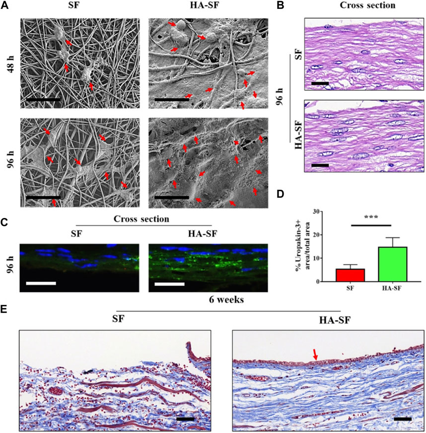 Bi-layer silk fibroin skeleton and bladder acellular matrix hydrogel  encapsulating adipose-derived stem cells for bladder reconstruction -  Biomaterials Science (RSC Publishing)
