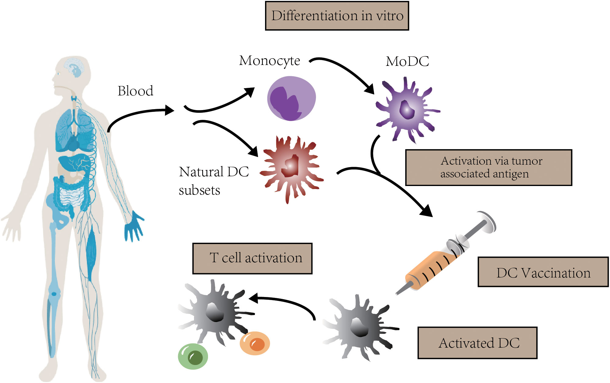 Frontiers  Dendritic cell vaccine of gliomas: challenges from