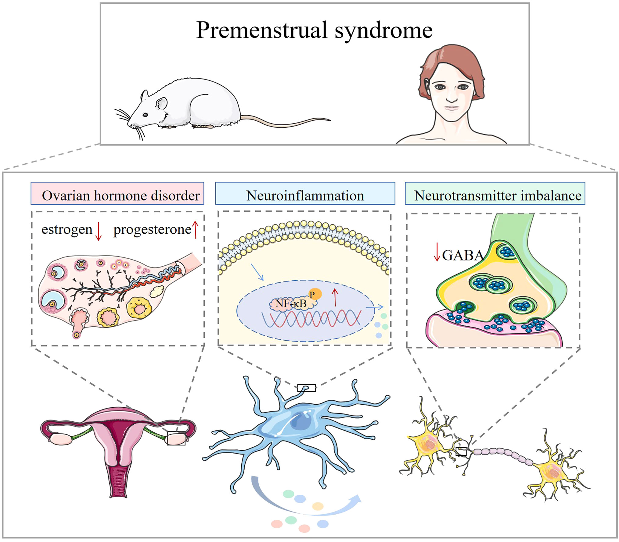 Aetiology, Diagnosis and Management of Premenstrual Syndrome