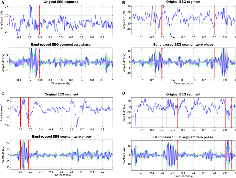 Frontiers | Stage-independent, single lead EEG sleep spindle detection