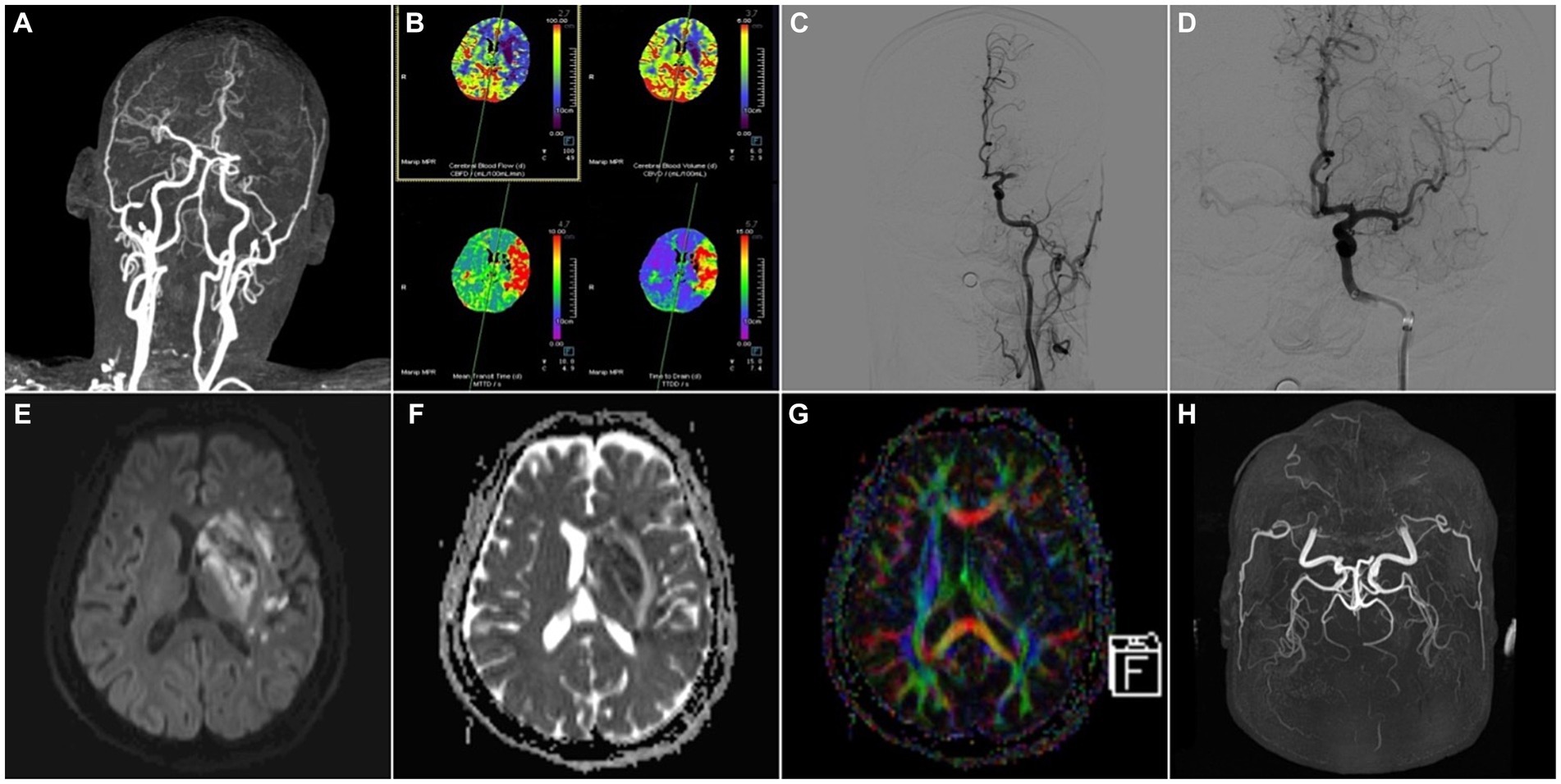 Frontiers | The novel imaging methods in diagnosis and assessment 