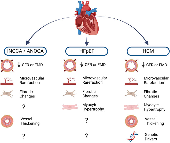 Frontiers  Endothelial cell dysfunction in cardiac disease
