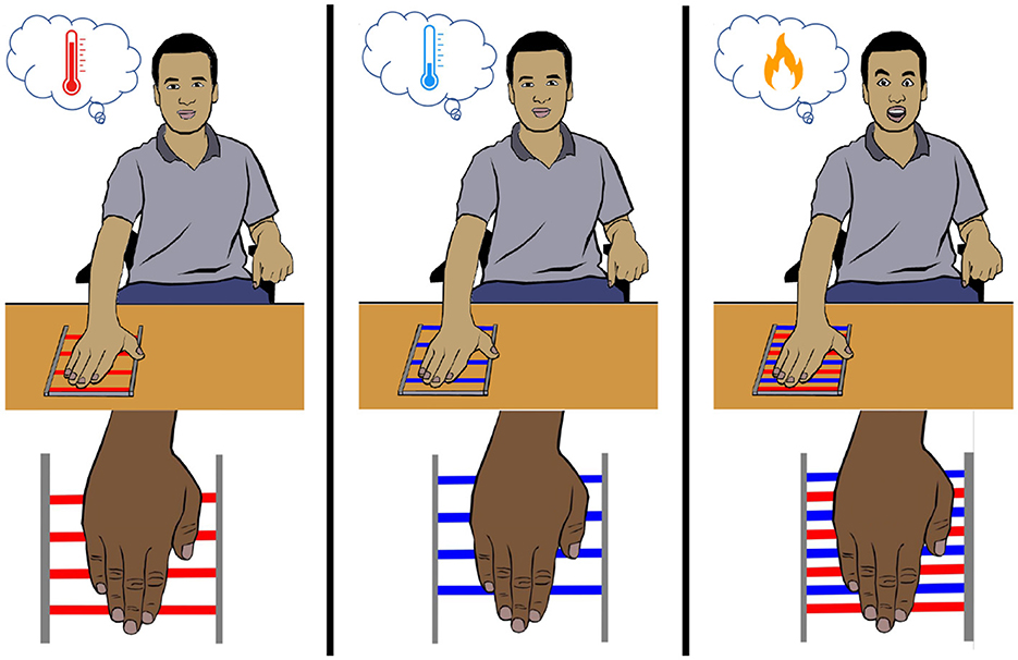 Frontiers  Verbal Suggestion Modulates the Sense of Ownership and Heat  Pain Threshold During the “Injured” Rubber Hand Illusion