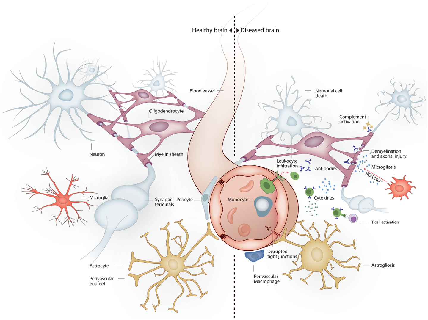 Frontiers Systemic Inflammation And The Brain Novel Roles Of Genetic Molecular And