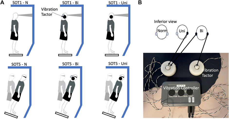 Frontiers The Sex Effect On Balance Control While Standing On