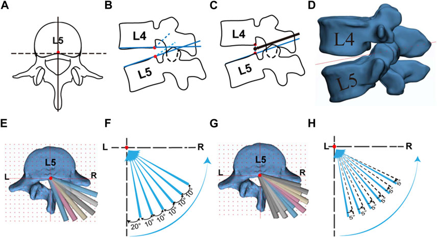 Frontiers  Load Distribution in the Lumbar Spine During Modeled