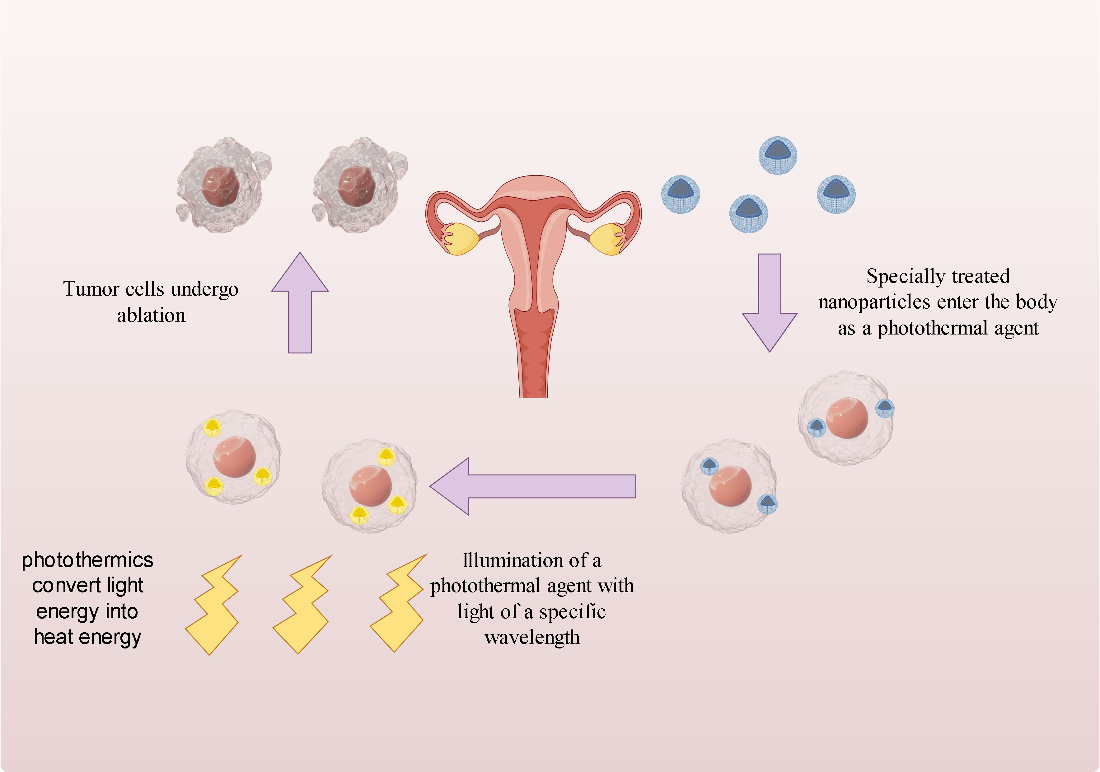 Frontiers | Recent status and trends of nanotechnology in cervical ...