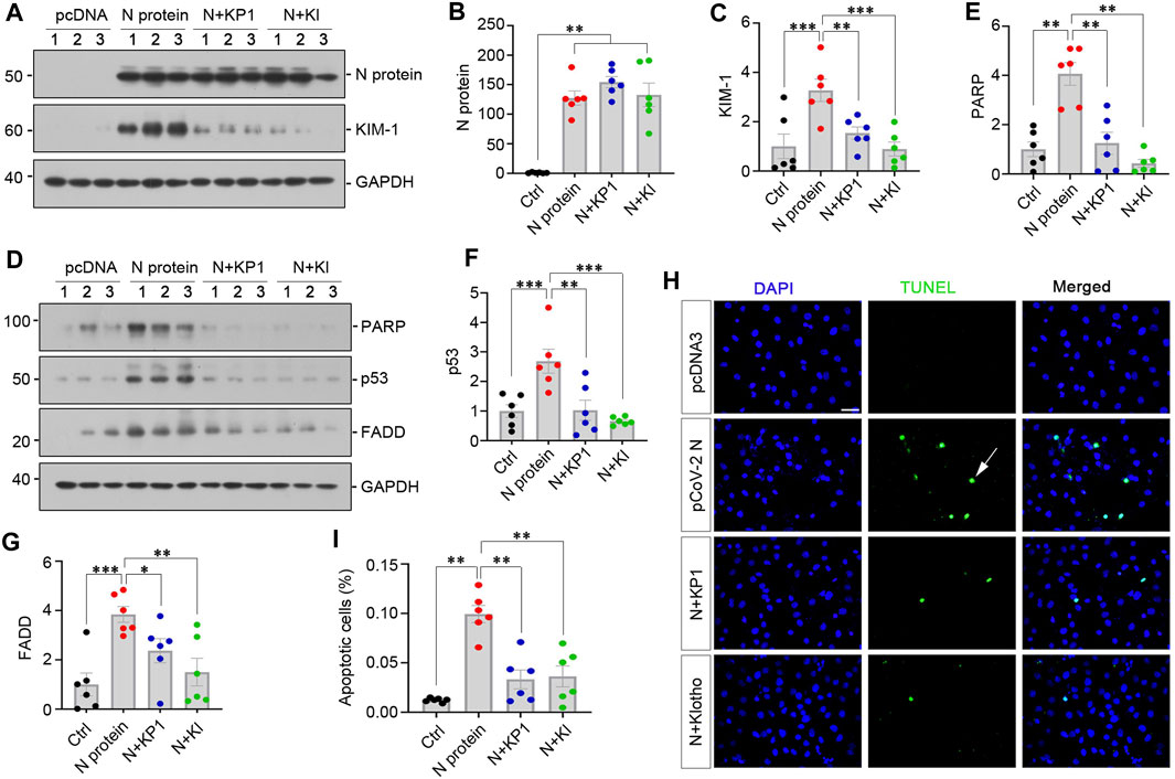 Frontiers | Klotho-derived peptide KP1 ameliorates SARS-CoV-2 ...